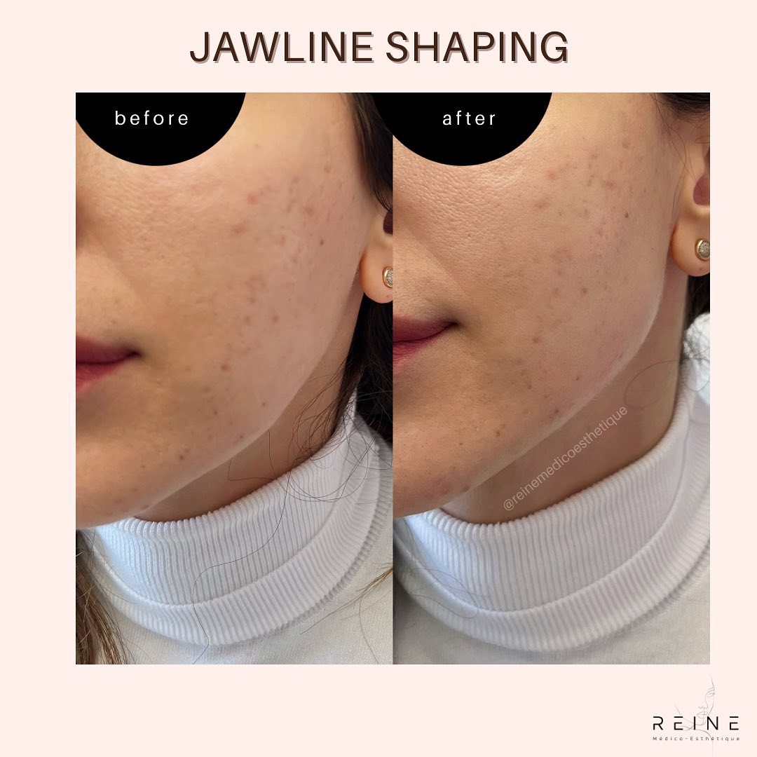 Reine Médico-Esthétique