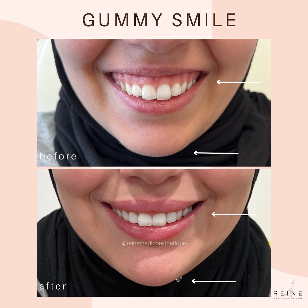 Reine Médico-Esthétique