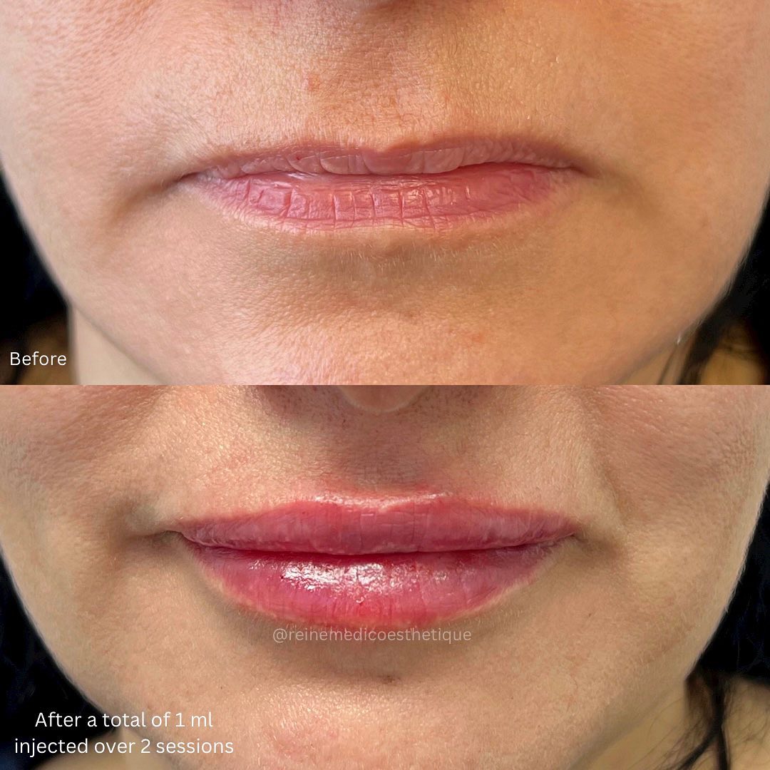 Reine Médico-Esthétique