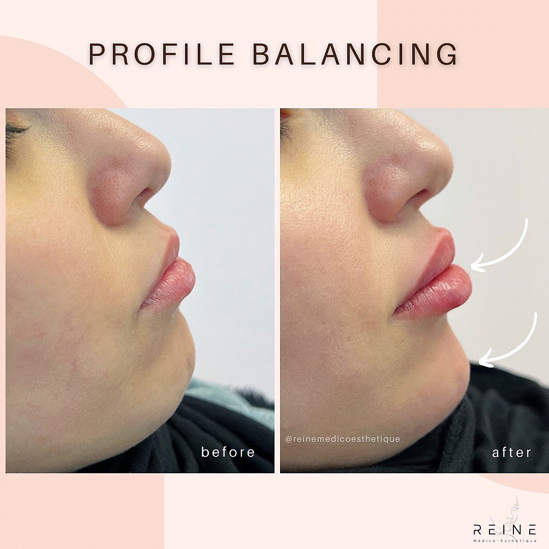 Reine Médico-Esthétique