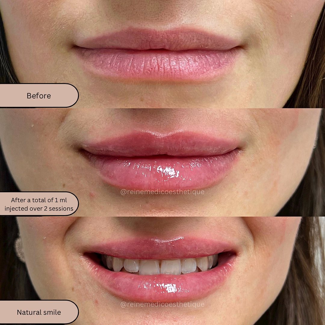 Reine Médico-Esthétique